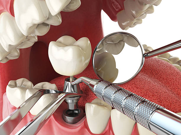 Best Walk-In Emergency Dental Services in Quincy, CA