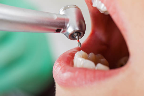 Best Urgent Dental Care for Toothaches in Quincy, CA